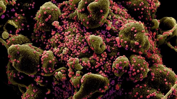 Журнал The Lancet обвинили в сокрытии фактов о коронавирусе 